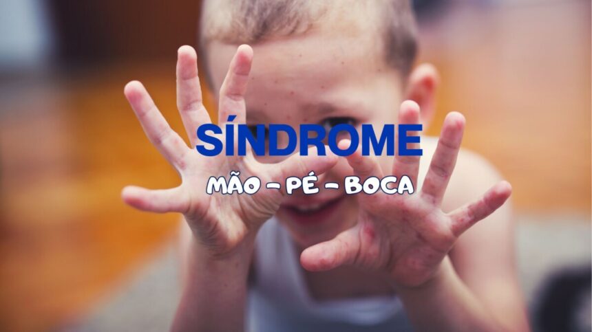 Município Intensifica Cuidados contra Síndrome Mão-Pé-Boca